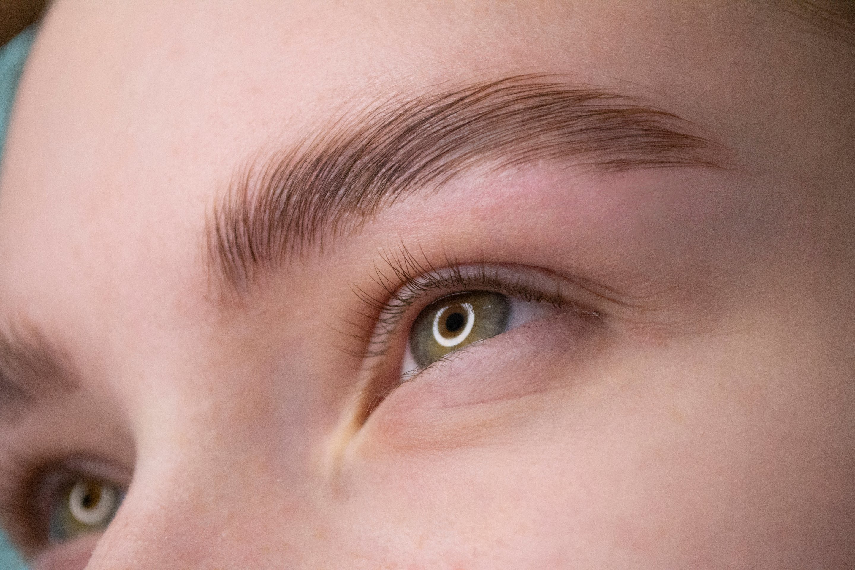 Wimpernkranzverdichtung bei Facettenreich